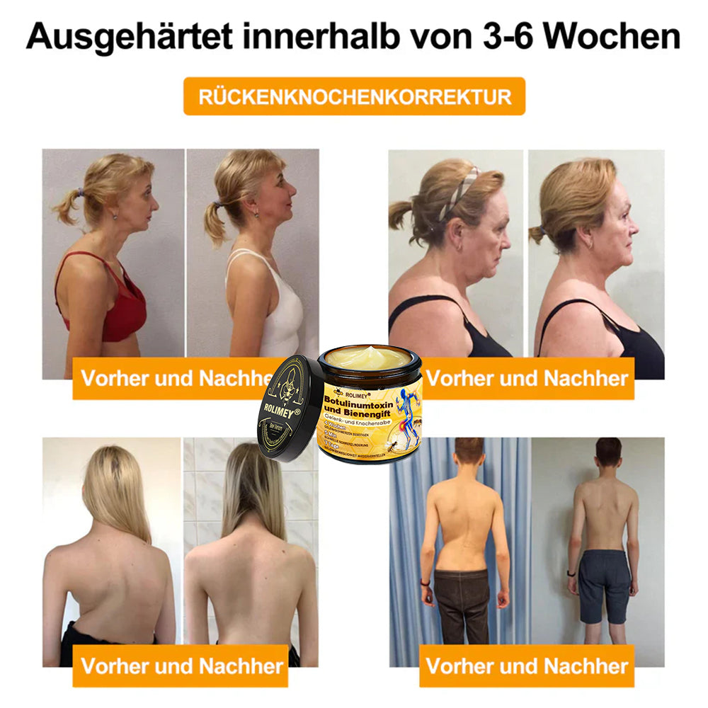 ✅ Offizieller Shop: Rolimey® Bienengift-Schmerzlinderungs Knochenheilungs Creme 👨‍⚕️(Reduzierung von Gelenkschwellungen, Schmerzen, Steifheit, Rötungen, Wärme, Muskelkater und Gelenkmüdigkeit)