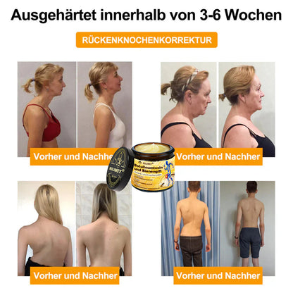 ✅ Offizieller Shop: Rolimey® Bienengift-Schmerzlinderungs Knochenheilungs Creme 👨‍⚕️(Reduzierung von Gelenkschwellungen, Schmerzen, Steifheit, Rötungen, Wärme, Muskelkater und Gelenkmüdigkeit)