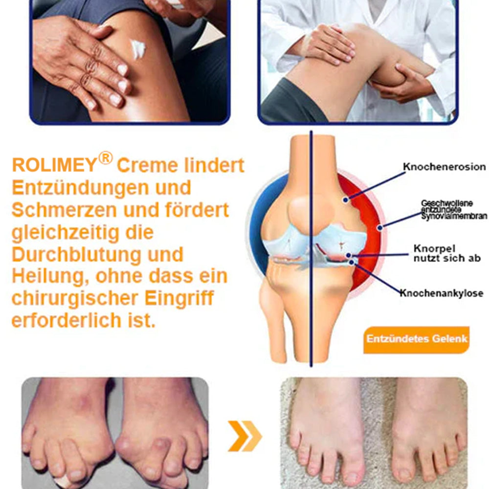 ✅ Offizieller Shop: Rolimey® Bienengift-Schmerzlinderungs Knochenheilungs Creme 👨‍⚕️(Reduzierung von Gelenkschwellungen, Schmerzen, Steifheit, Rötungen, Wärme, Muskelkater und Gelenkmüdigkeit)