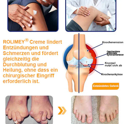 ✅ Offizieller Shop: Rolimey® Bienengift-Schmerzlinderungs Knochenheilungs Creme 👨‍⚕️(Reduzierung von Gelenkschwellungen, Schmerzen, Steifheit, Rötungen, Wärme, Muskelkater und Gelenkmüdigkeit)
