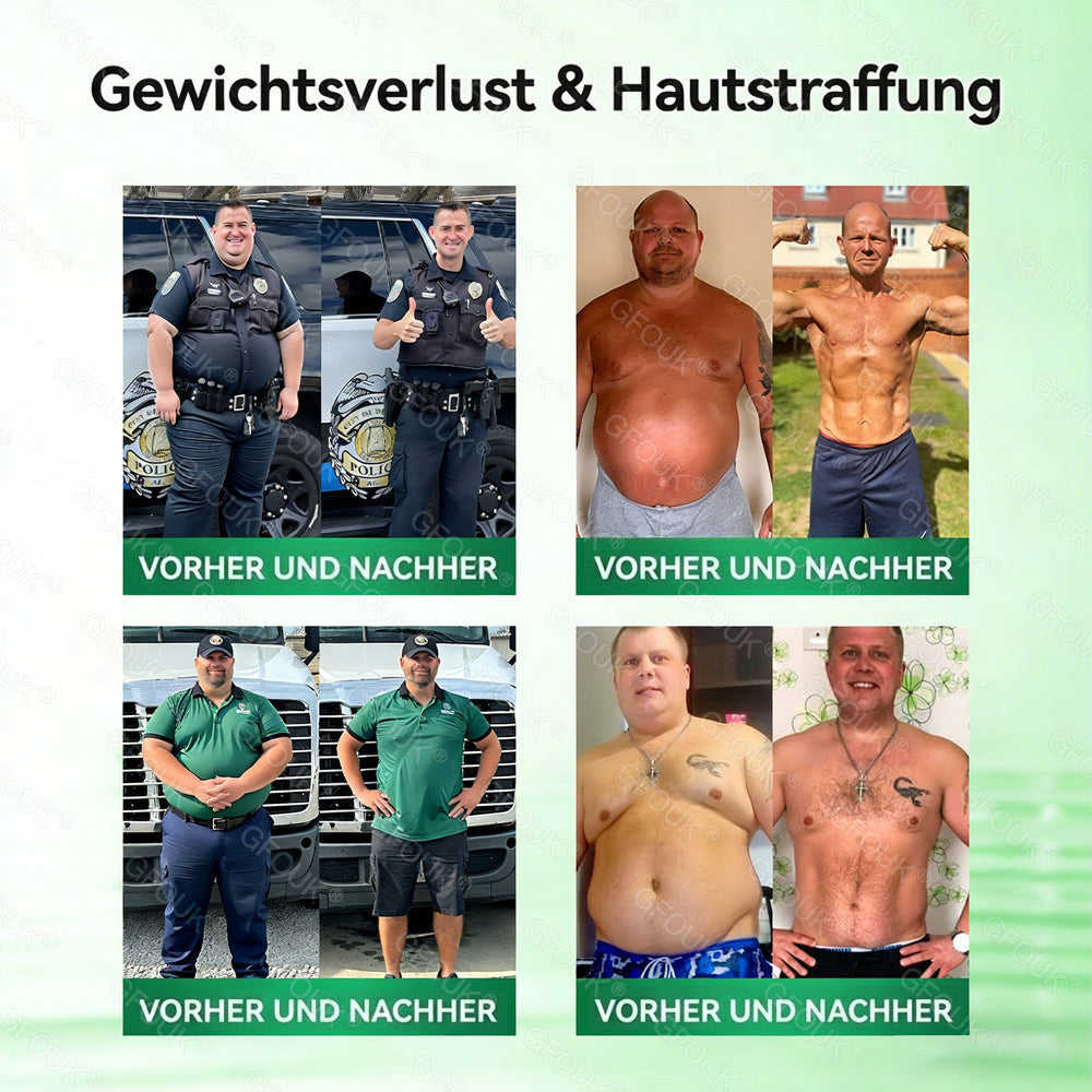 🫣🇩🇪Offizieller Shop | ✅ GFOUK® Moringa Berberinex NAD+ 10-in-1 Nano-Mikronadel-Patch (Nur einmal täglich, sichtbare Veränderungen in 7 Tagen) ✅ Für Übergewicht, lockere Haut, Diabetes, Schlafapnoe, Gelenkprobleme und mehr