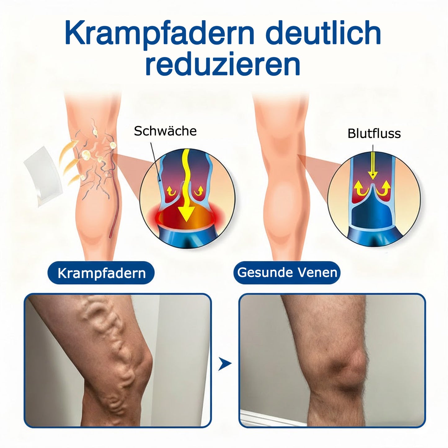 🇩🇪👨‍⚕️💥 GFOUK® VeinTarget Mikronadel-Pflaster ⚡ Sofortige Linderung, Langfristige Ergebnisse