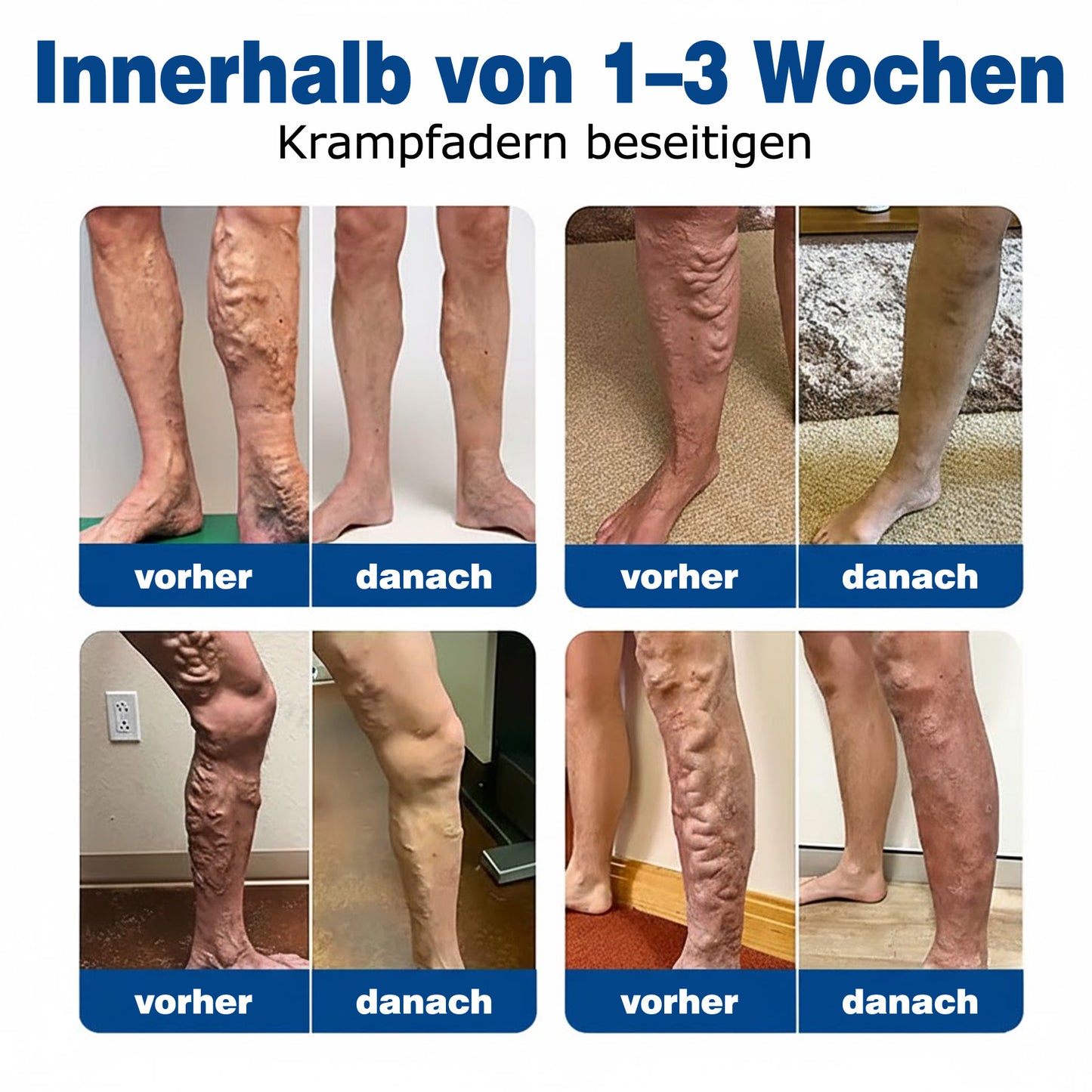 🇩🇪👨‍⚕️💥 GFOUK® VeinTarget Mikronadel-Pflaster ⚡ Sofortige Linderung, Langfristige Ergebnisse